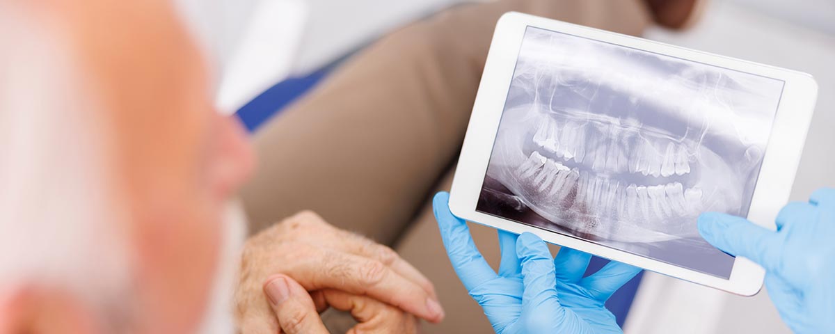 Wurzelbehandelte Zähne gefährlich