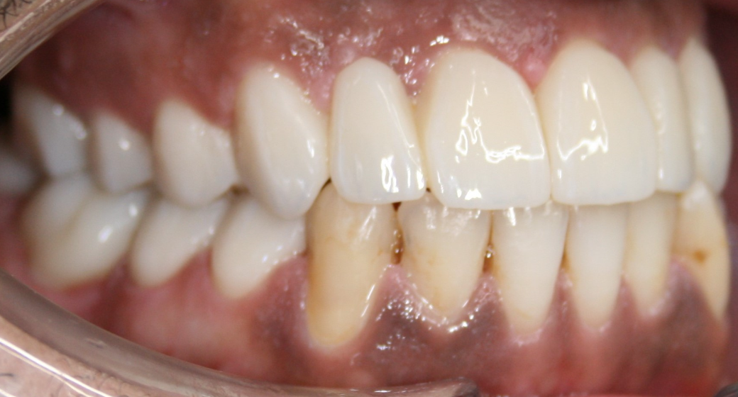 Vorher-Nachher-Bild | Brücken von  Ahmad Saleh | Düsseldorf c0c7c76d Nachher-Bild