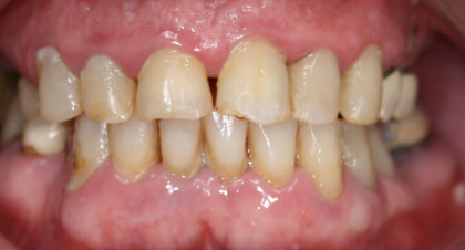 Vorher-Nachher-Bild | Brücken von  Ahmad Saleh | Düsseldorf c0c7c76d Vorher-Bild