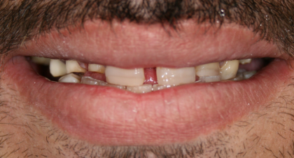 Vorher-Nachher-Bild | Brücken von  Ahmad Saleh | Düsseldorf c0c7c76d Vorher-Bild