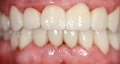 Vorher-Nachher-Bild | Brücken von  Ahmad Saleh | Düsseldorf c0c7c76d Nachher-Bild