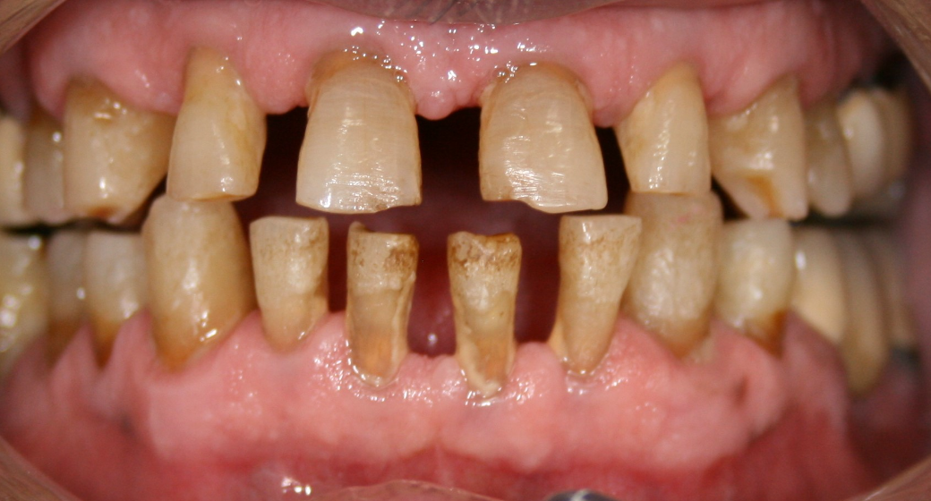 Behandlung Vorher-Nachher-Bild | Kieferorthopädie von  Ahmad Saleh | Düsseldorf c0c7c76d Nachher-Bild