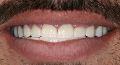 Vorher-Nachher-Bild | Brücken von  Ahmad Saleh | Düsseldorf c0c7c76d Nachher-Bild